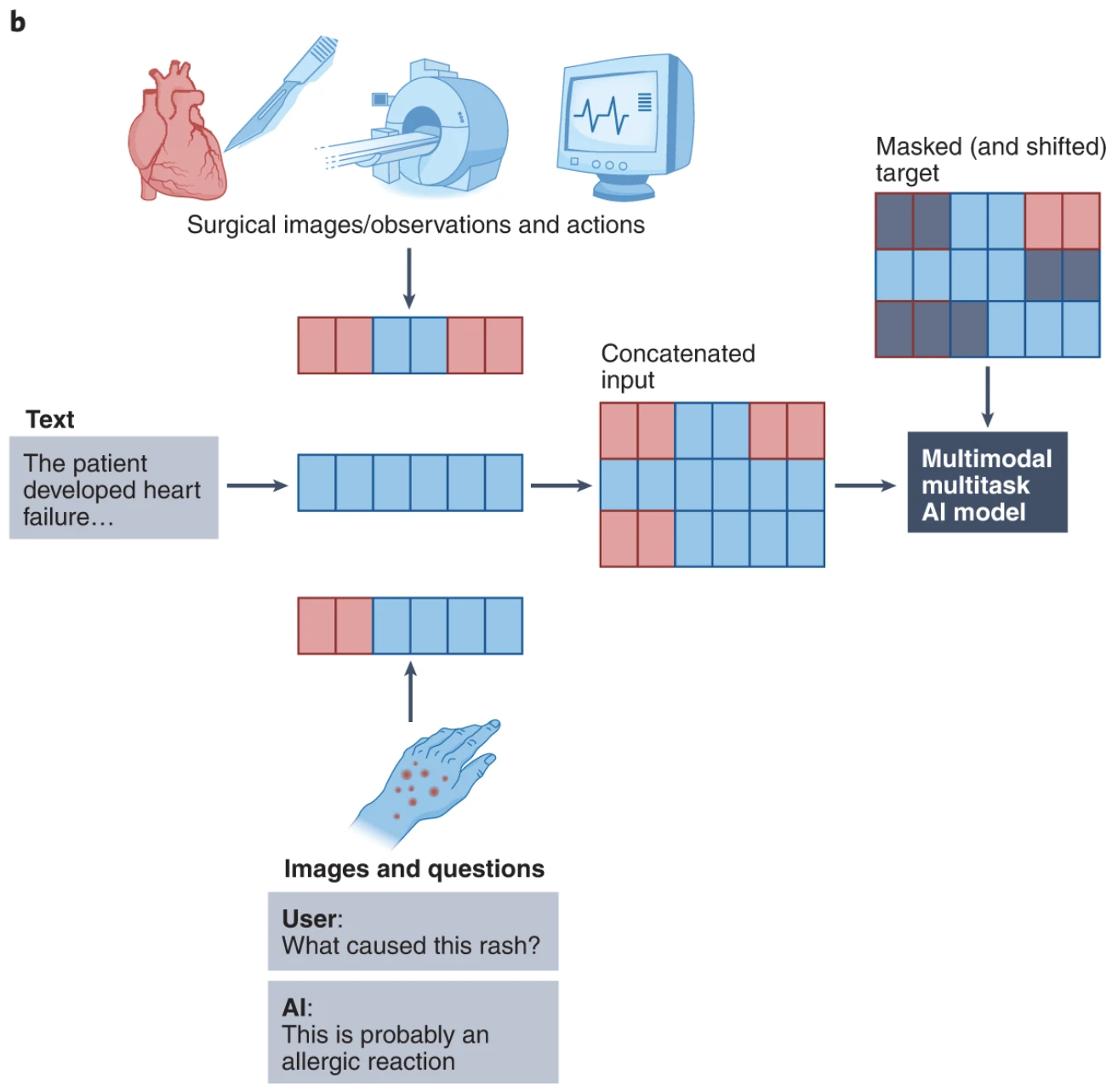 Multimodal AI in healthcare